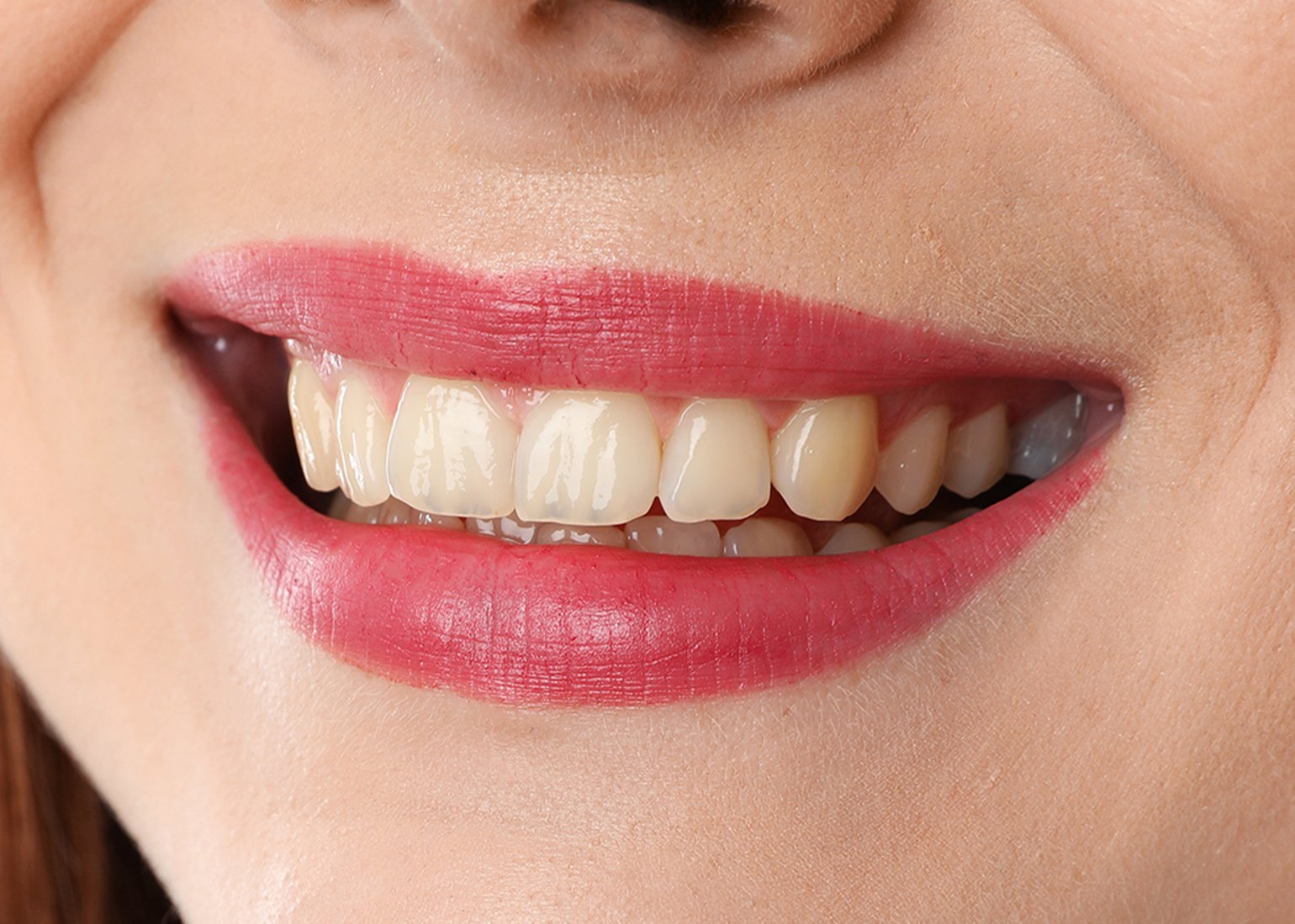 <span class="bt_bb_before_after_image_before_text">Before</span>